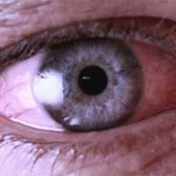 Капли Око-Плюс борются со всеми глазными болезнями
