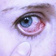 Визиум быстро излечивает любые заболевания глаз