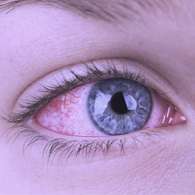 С препаратом Crystal Eyes возможно избавиться от любого заболевания глаз